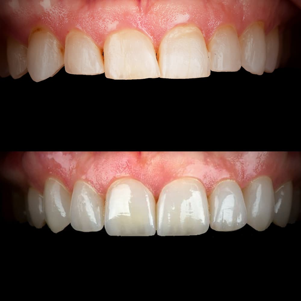 Before and after dental case 16